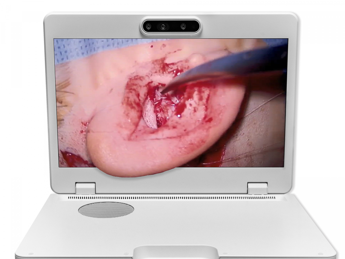 达擎之＂Heads-up 3D显微手术显示系统＂，整合4K裸眼3D显示及眼球追踪系统，具备快速追踪人眼移动位置功能，减轻医师长时间维持固定姿势的负担，让医师能有更宽广清晰的3D立体视野及更舒适的姿势来执行手术。